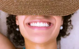 La técnica de blanqueamiento dental es furor; se utiliza para rejuvenecer la sonrisa, borrar manchas y darles un aspecto renovado a los dientes. Foto: Canva