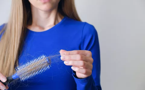 Época de la berenjena: 7 mitos y verdades sobre la caída del pelo