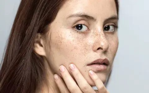 ¿qué tenés que saber para tratarlas durante el invierno?