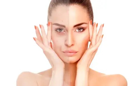 Cómo lograr luminosidad natural en la piel con cinco aliados fundamentales Cómo lograr luminosidad natural en la piel con cinco aliados fundamentales