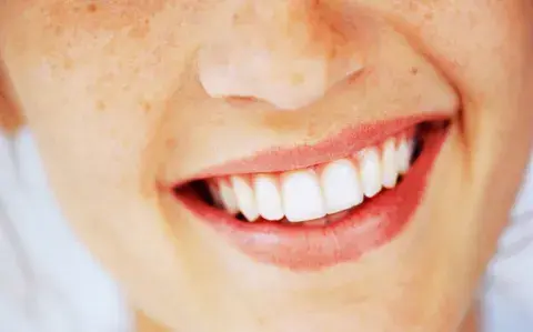 Día Mundial de la Salud Bucal: lo que la boca dice sobre tu salud Día Mundial de la Salud Bucal: lo que la boca dice sobre tu salud