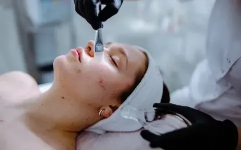 Rosácea en invierno: por qué empeora y cómo cuidar la piel cuando bajan las temperaturas