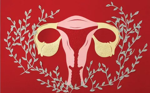 Cáncer de ovario: por qué se genera, cuáles son sus síntomas y cómo se trata
