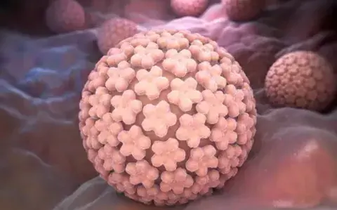 Las 4 claves para prevenir el HPV