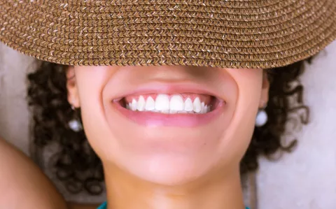 8 claves sobre el blanqueamiento dental y qué resultados esperar de este procedimiento