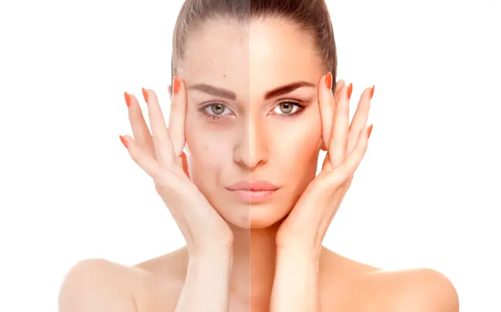 Glow puro: cómo lograr luminosidad natural en la piel.