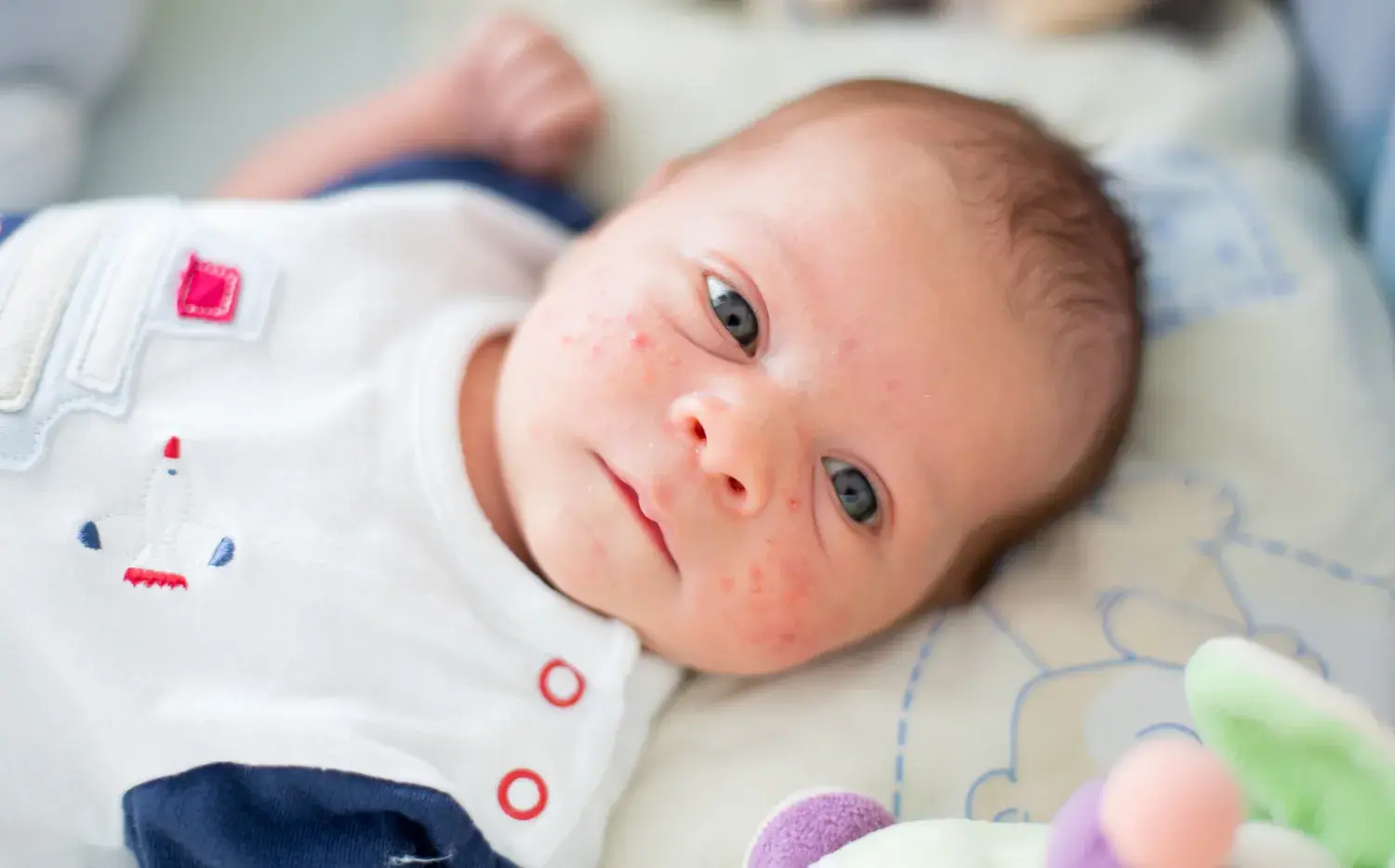 10 hallazgos normales en la piel de tu bebé (y por qué no deberías preocuparte) 10 hallazgos normales en la piel de tu bebé (y por qué no deberías preocuparte)